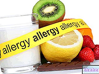 Ruoka-allergia