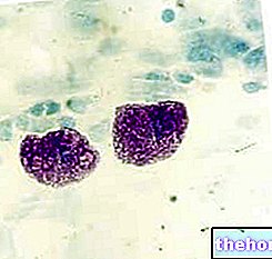 Mastocitos