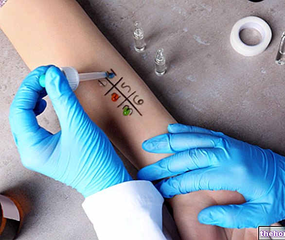 אלרגיות לבדיקת דקירות: בדיקת דקירות עור ובדיקת דקירה על ידי דקירה