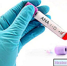 ANA - Anticorps anti-noyau