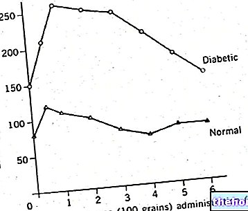 Courbe glycémique - Test de tolérance au glucose par voie orale