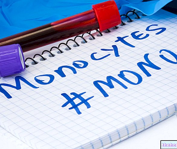 Monocytose (monocytes élevés) : quand s'inquiéter ?