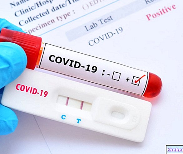 COVID-19 serologiske tests: Hvad er de, og hvordan fungerer de?