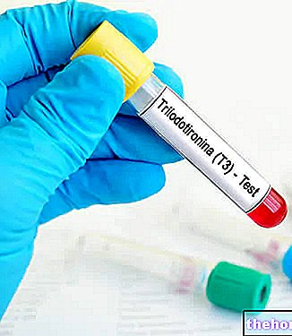 Triiodothyronine sanguine - T3 totale, T3 libre