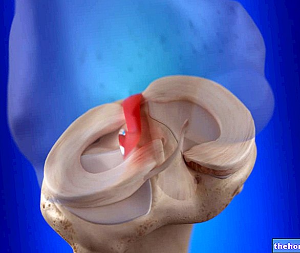 Anterior Cruciate Ligament: Vad är det? Anatomi, funktion och patologier