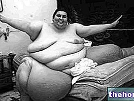 Lelaki paling gemuk di dunia