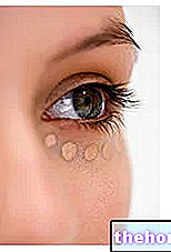 Hoito tummia silmänalusia vaalentavilla aineilla