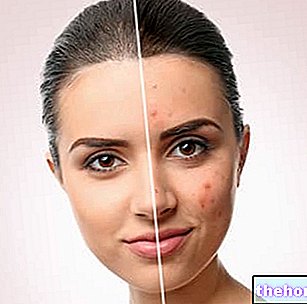 Cosmetische behandeling voor de vette huid