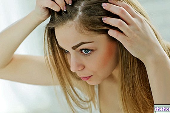 Kako ravnati z izpadanjem las?