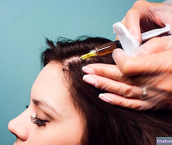 PRP Hair - Điều trị rụng tóc