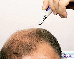 Remedies for Baldness