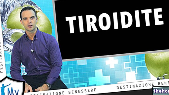 Tiroiditis: causas, síntomas, tratamiento