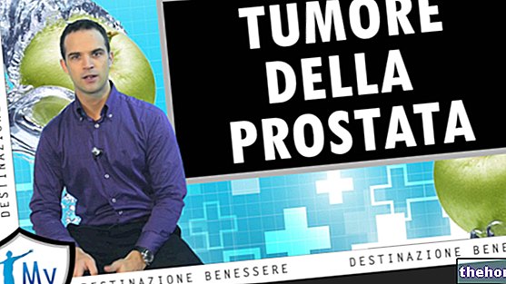 Видеоклипове за рак на простатата - причини, симптоми, лечение