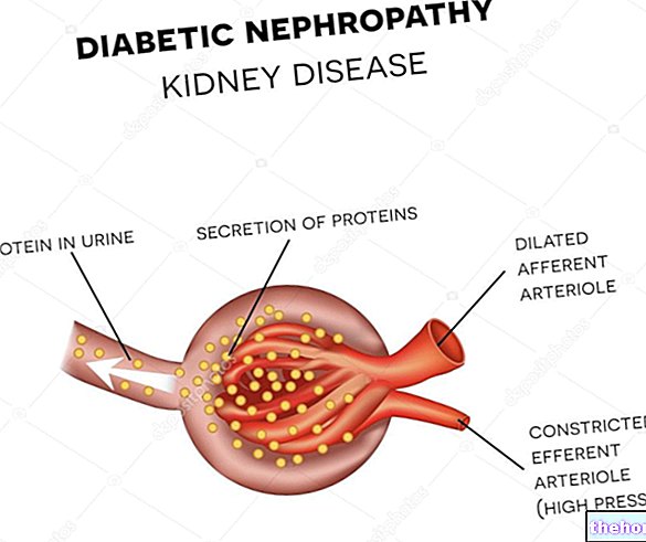 Діабетична нефропатія: причини та патофізіологія
