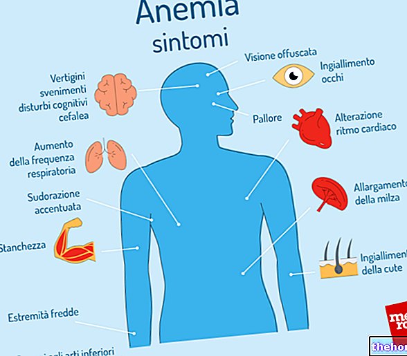 Анемија недостатка гвожђа: симптоми, дијагноза, лечење