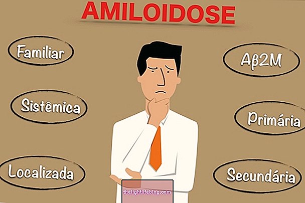 Comment identifier l'amylose