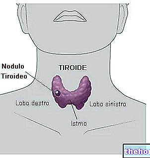 Възли на щитовидната жлеза