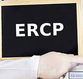 Cholangiopancreatography - ERCP