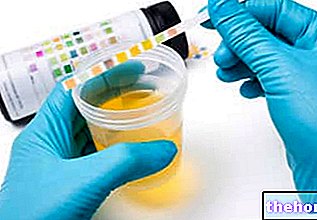 Examen d'urine - Analyse d'urine