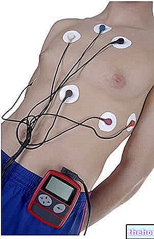 Holter Cardiaque - ECG Holter