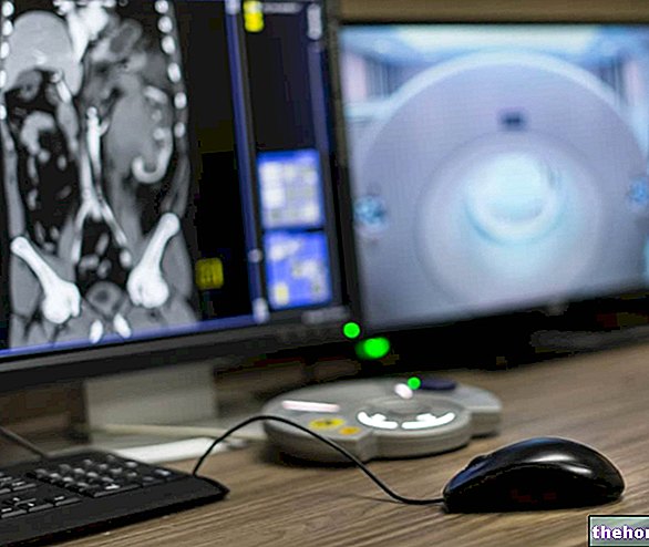 CT -scanning af maven: Hvad er det? Anvendelser, forberedelse, procedure og resultater