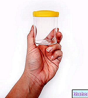 Urates amorphes dans l'urine