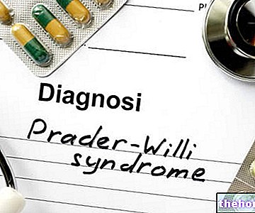 Médicaments pour traiter le syndrome de Prader-Willi