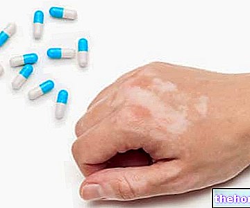 Lijekovi za liječenje vitiliga