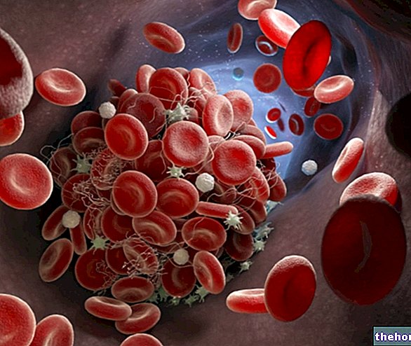 Pembekuan darah: bagaimana pembekuan darah?