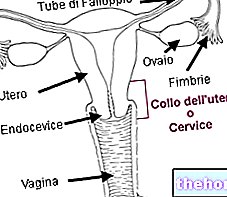 Utérus rétroversé, rétroversé ou rétroversé