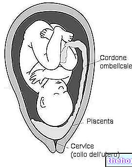 Placenta Previa - příznaky, diagnostika a terapie