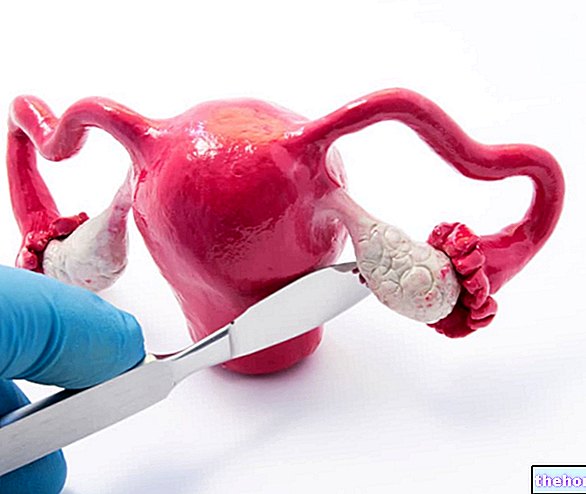 Ovariektomie: Co to je? Když je to potřeba, jak se to dělá a rizika
