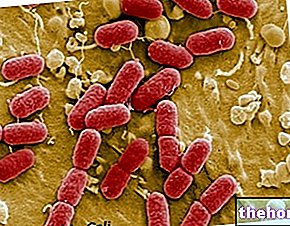 Escherichia coli ja ruoka -taudit