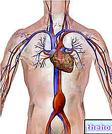 Kõhu aordi aneurüsm