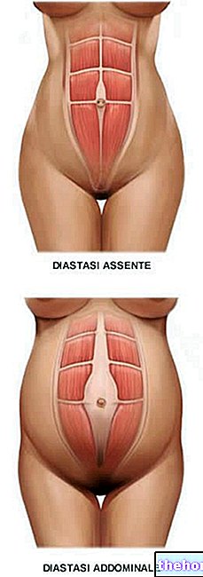 Diastáza