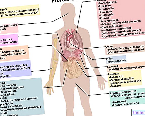 Fibrose kystique - Diagnostic et traitement