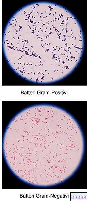 Gram négatif - Bactéries Gram -