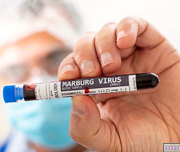 Maladie à virus de Marburg - Fièvre de Marburg