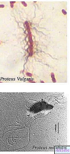 Proteus: nakkused ja haigused