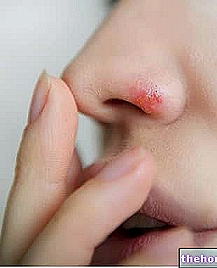 תרופות נגד הרפס באף
