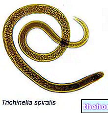 Trichinella