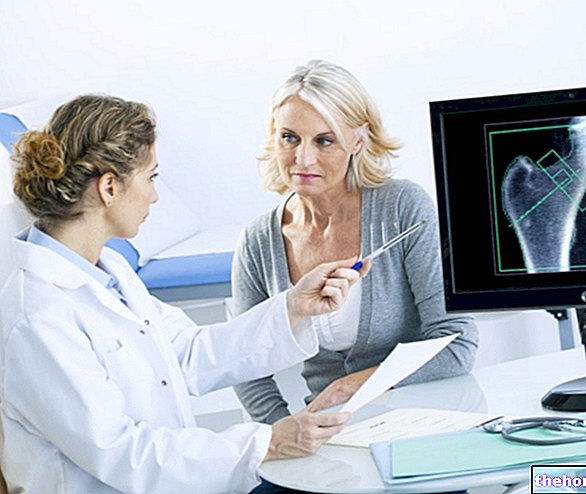 Osteoporosis en la menopausia: causas y tratamiento