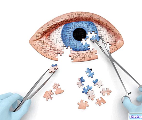 Хірургія катаракти: як це працює?