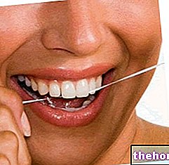 dents-santé - Abcès dentaire : diagnostic, thérapie et pronostic