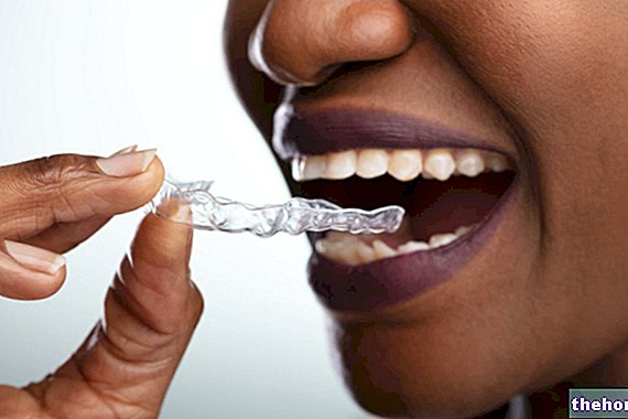 歯ぎしりのための一口：それが何であり、どれを選ぶべきか