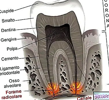 Гранульома зубів