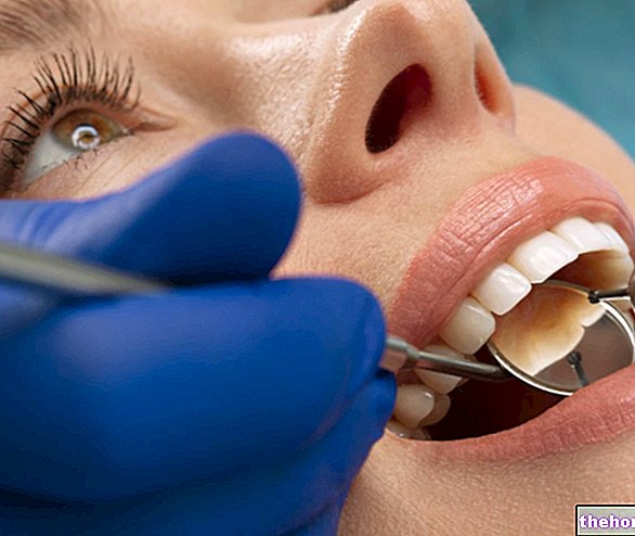 Tandpine: Hvad skal man gøre
