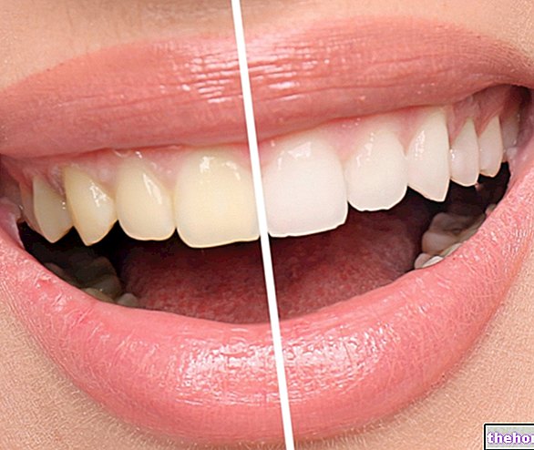 Naravno beljenje zob