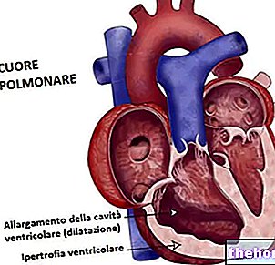 pulmoner kalp