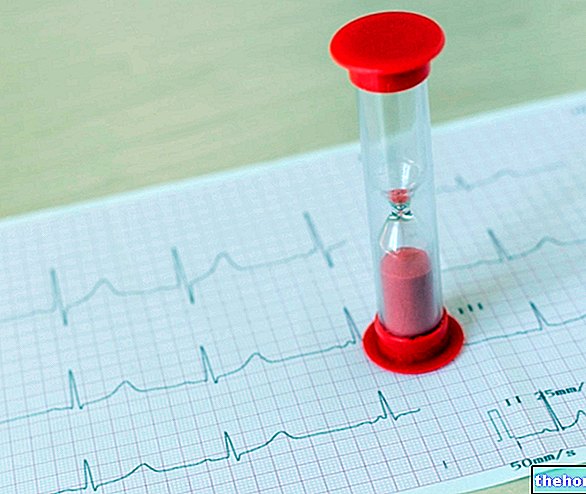 Mort subite d'origine cardiaque : qu'est-ce que c'est, symptômes, causes et prévention